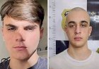 Morre adolescente de 16 anos agredido por piloto Pedro Turra no DF; vítima estava internada há 16 dias